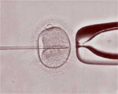 46岁广州做试管助孕成功率助力不孕不育夫妇圆儿女梦