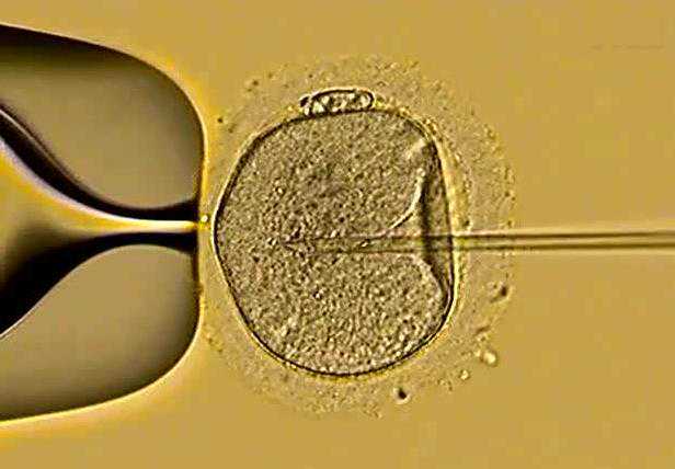 人工授精能生双胞胎吗