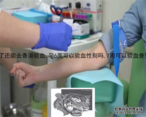 5周验血测男女准吗可以改变吗_香港验血能吃药吗_几周是最准呢!