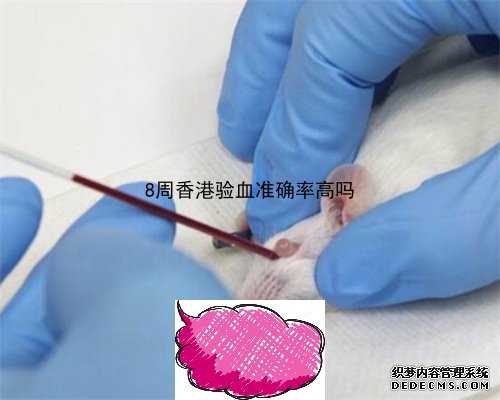 验血鉴定胎儿9周可以性别准吗_怎么样不用去香港可以验血胎儿性别_测性别哪家