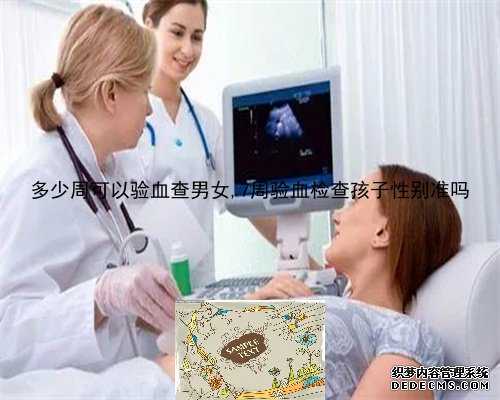 上海鉴定胎儿性别3个月准,香港母体验血13组d